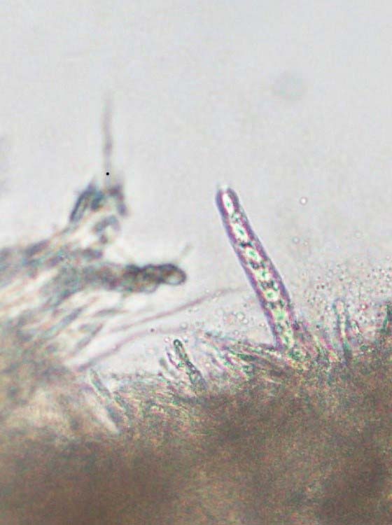 Tar spot under microscope