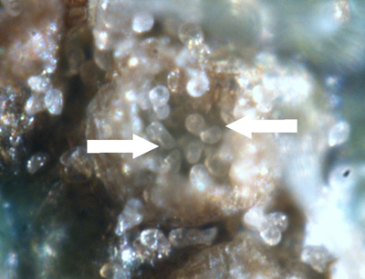 This enlarged (130X) view shows the volcano shaped pustules and the arrows point out the opening. Note around the edges and inside of the pustule you can see the spores erupting from the top.