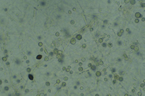 Chlamydospores