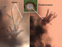 Conidia-bearing structures