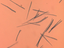 Conidia