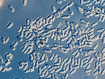 Macroconidia