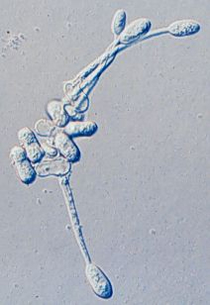 Secondary conidia