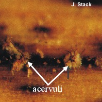 acervuli in corn