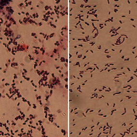 A comparison of the bacteria that cause bacterial wilt of dry beans and Gossâ wilt of corn. The rods of Curtobacterium (left) in the dry bean wilt pathogen are shorter and fatter than the Gossâ wilt pathogen, Clavibacter (right).  