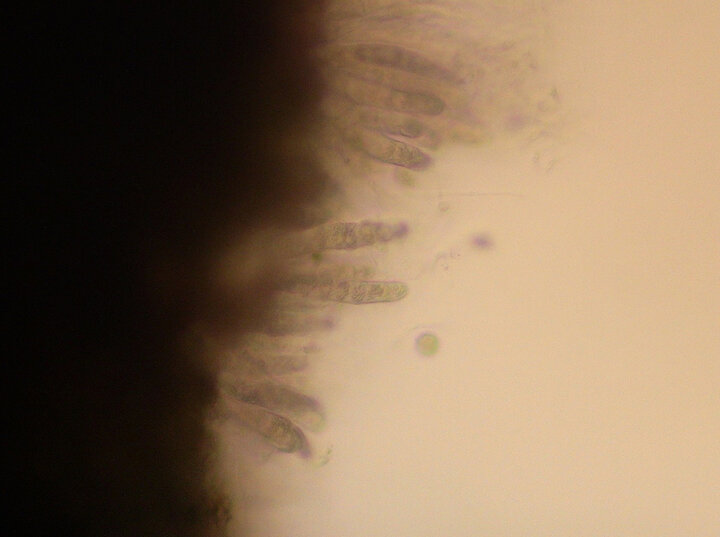 Phyllachora maydis spores